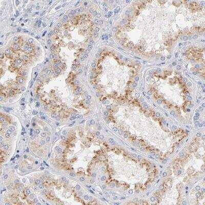 Immunohistochemistry-Paraffin: Factor XII Antibody [NBP1-86518]