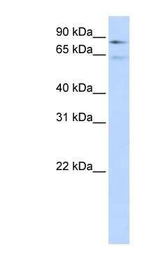 Western Blot: Factor XIIIb Antibody [NBP1-58012]
