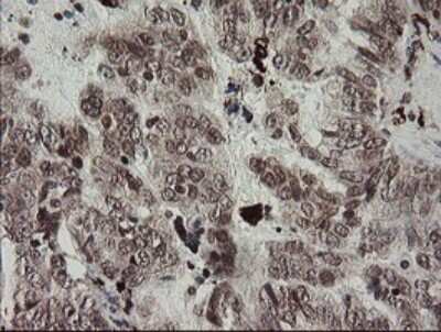 Immunohistochemistry: Factor XIIIa Antibody (OTI6F5) [NBP2-45562]
