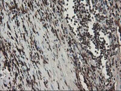 Immunohistochemistry: Factor XIIIa Antibody (OTI6F5) [NBP2-45562]