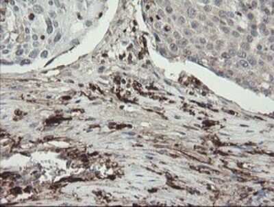 Immunohistochemistry: Factor XIIIa Antibody (OTI6F5) [NBP2-45562]