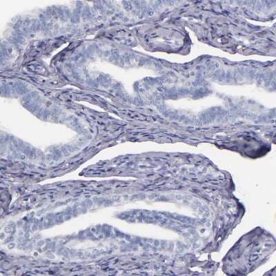 Immunohistochemistry-Paraffin: Factor XIIIa Antibody [NBP1-83938]