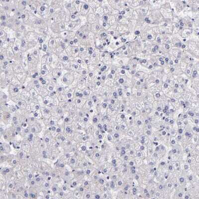 Immunohistochemistry-Paraffin: Factor XIIIa Antibody [NBP1-83938]