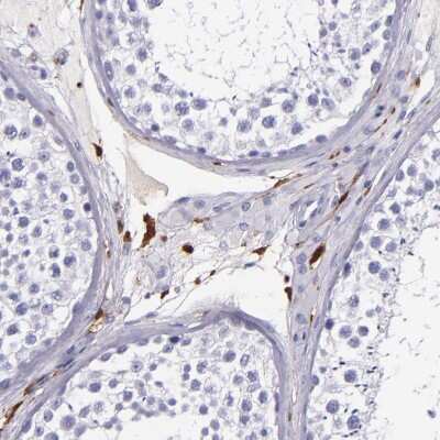 Immunohistochemistry-Paraffin: Factor XIIIa Antibody [NBP1-83938]