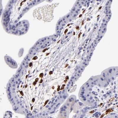 Immunohistochemistry-Paraffin: Factor XIIIa Antibody [NBP1-83938]