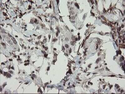 Immunohistochemistry: Factor XIIIa Antibody (OTI6F5) - Azide and BSA Free [NBP2-70696]