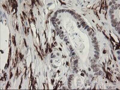 Immunohistochemistry: Factor XIIIa Antibody (OTI6F5) - Azide and BSA Free [NBP2-70696]