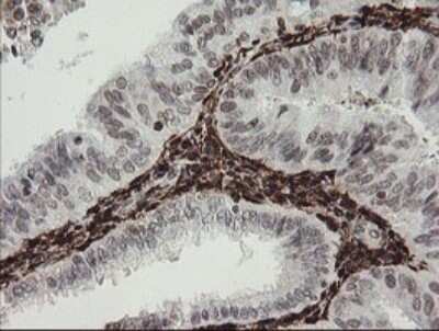 Immunohistochemistry: Factor XIIIa Antibody (OTI6F5) - Azide and BSA Free [NBP2-70696]