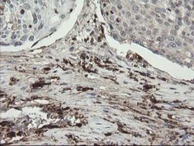 Immunohistochemistry: Factor XIIIa Antibody (OTI6F5) - Azide and BSA Free [NBP2-70696]