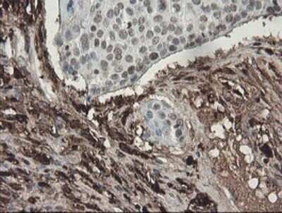 Immunohistochemistry: Factor XIIIa Antibody (OTI6F5) - Azide and BSA Free [NBP2-70696]