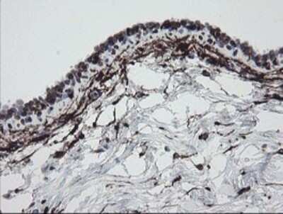 Immunohistochemistry: Factor XIIIa Antibody (OTI6F5) - Azide and BSA Free [NBP2-70696]