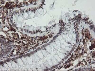 Immunohistochemistry: Factor XIIIa Antibody (OTI6F5) - Azide and BSA Free [NBP2-70696]