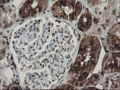 Immunohistochemistry: Factor XIIIa Antibody (OTI6F5) - Azide and BSA Free [NBP2-70696]