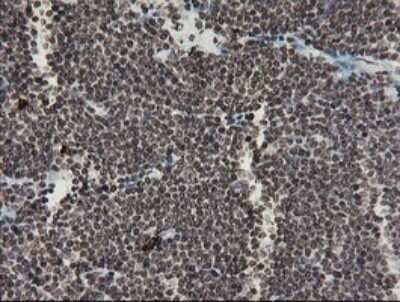 Immunohistochemistry: Factor XIIIa Antibody (OTI6F5) - Azide and BSA Free [NBP2-70696]