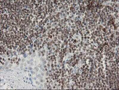 Immunohistochemistry: Factor XIIIa Antibody (OTI6F5) - Azide and BSA Free [NBP2-70696]