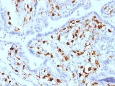 Immunohistochemistry-Paraffin: Factor XIIIa Antibody (SPM180) - Azide and BSA Free [NBP2-54480]