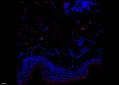 Immunohistochemistry-Frozen: Factor XIIIa Antibody (SPM180) [NBP2-53238]