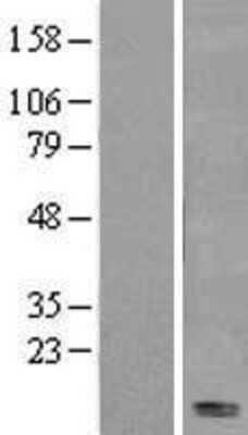 Western Blot: Fas/TNFRSF6/CD95 Overexpression Lysate [NBL1-10598]