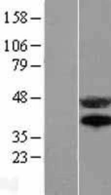 Western Blot: Fas/TNFRSF6/CD95 Overexpression Lysate [NBL1-10599]