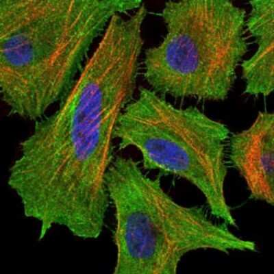 Immunocytochemistry/ Immunofluorescence: Fas/TNFRSF6/CD95 Antibody (4F8H6) - BSA Free [NBP2-37515]