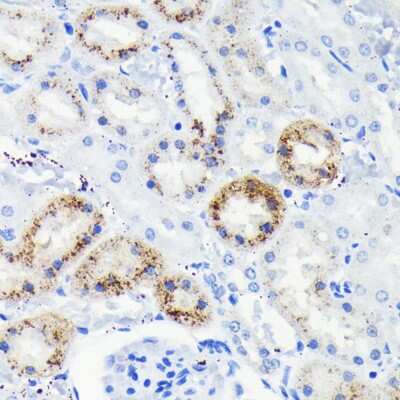 Immunohistochemistry-Paraffin: Fas/TNFRSF6/CD95 Antibody (5D10O3) [NBP3-15788]