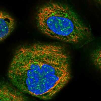 Immunocytochemistry/ Immunofluorescence: Fas/TNFRSF6/CD95 Antibody [NBP1-89034]