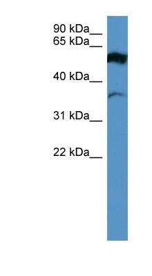 Western Blot: Fascin 2 Antibody [NBP1-79776]