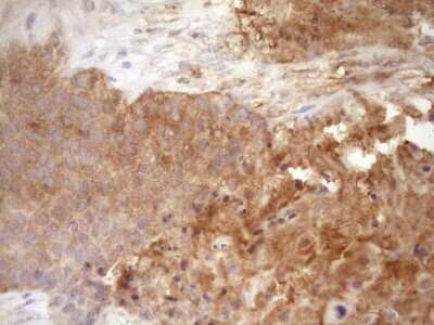 Immunohistochemistry: Fascin Antibody (OTI3B4) [NBP2-45737]