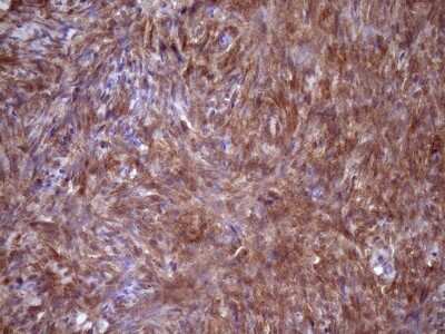 Immunohistochemistry: Fascin Antibody (OTI3B4) [NBP2-45737]