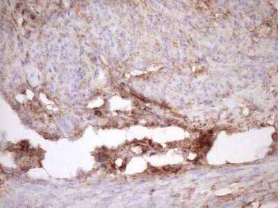 Immunohistochemistry: Fascin Antibody (OTI3B4) [NBP2-45737]