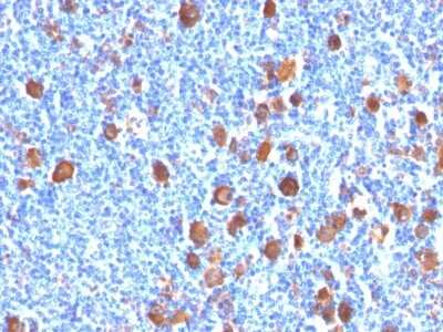 Immunohistochemistry-Paraffin: Fascin Antibody (FSCN1/416) [NBP2-44382]