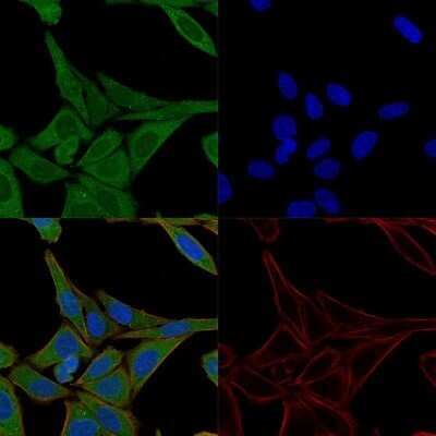 Immunocytochemistry/ Immunofluorescence: Fascin Antibody (FSCN1/417) - Azide and BSA Free [NBP2-47801]