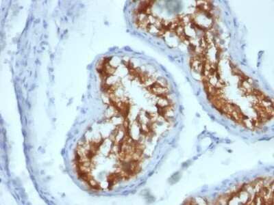 Immunohistochemistry-Paraffin: Fascin Antibody (FSCN1/417) - Azide and BSA Free [NBP2-47801]