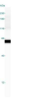 Simple Western: Fascin Antibody (FSCN1/417) [NBP2-44383]