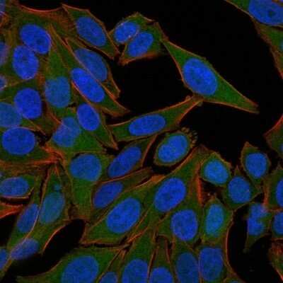 Immunocytochemistry/ Immunofluorescence: Fascin Antibody (FSCN1/418) - Azide and BSA Free [NBP2-47802]