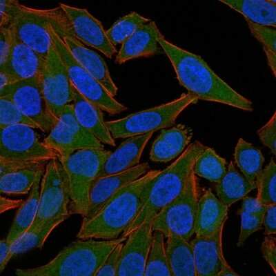 Immunocytochemistry/ Immunofluorescence: Fascin Antibody (FSCN1/418) [NBP2-44385]