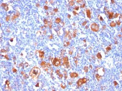 Immunohistochemistry-Paraffin: Fascin Antibody (FSCN1/418) [NBP2-44385]