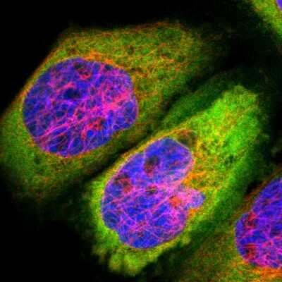 Immunocytochemistry/ Immunofluorescence: Fascin Antibody [NBP1-91887]