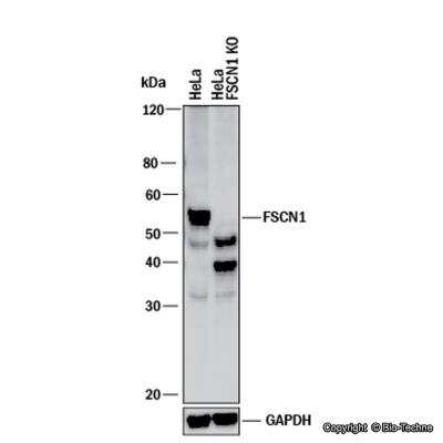Knockdown Validated: Fascin Antibody [NBP1-91887]