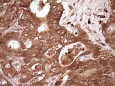 Immunohistochemistry: Fascin Antibody (OTI3B4) - Azide and BSA Free [NBP2-71294]