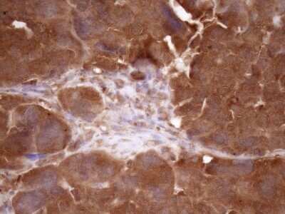 Immunohistochemistry: Fascin Antibody (OTI3B4) - Azide and BSA Free [NBP2-71294]