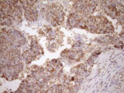 Immunohistochemistry: Fascin Antibody (OTI3B4) - Azide and BSA Free [NBP2-71294]