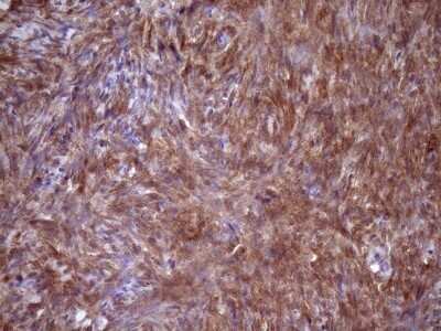 Immunohistochemistry: Fascin Antibody (OTI3B4) - Azide and BSA Free [NBP2-71294]