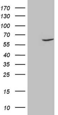 Western Blot: Fascin Antibody (OTI3B4)Azide and BSA Free [NBP2-71294]