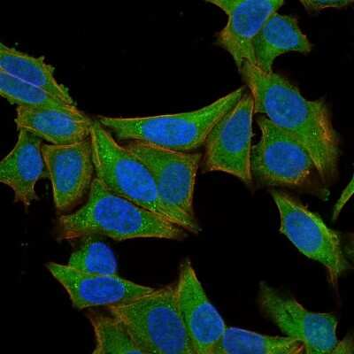 Immunocytochemistry/ Immunofluorescence: Fascin Antibody (SPM133) [NBP2-44384]