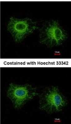 Immunocytochemistry/ Immunofluorescence: Fast skeletal myosin light chain 1 Antibody [NBP2-16433]