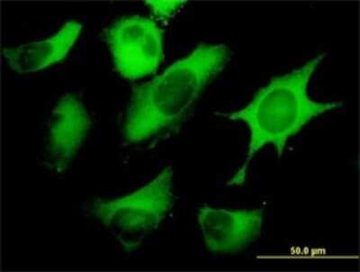 Immunocytochemistry/ Immunofluorescence: Fatty Acid Synthase/FASN Antibody (3F2-1F3) [H00002194-M01]