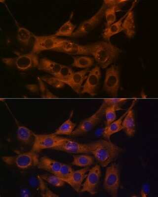 Immunocytochemistry/ Immunofluorescence: Fatty Acid Synthase/FASN Antibody (4U9S3) [NBP3-15634]