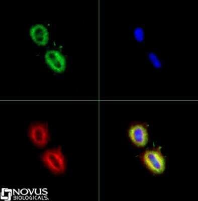 Immunocytochemistry/ Immunofluorescence: Fatty Acid Synthase/FASN Antibody [NB400-114]
