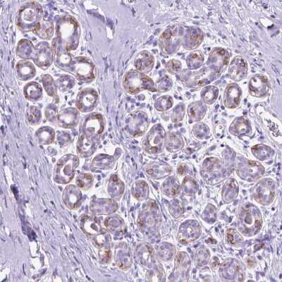 Immunohistochemistry: Fatty Acid Synthase/FASN Antibody [NBP2-49213]